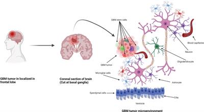 An overview of glioblastoma multiforme and temozolomide resistance: can LC-MS-based proteomics reveal the fundamental mechanism of temozolomide resistance?